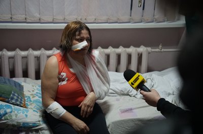 Атака дронів на рейсовий автобус: поранена миропільчанка розповіла про російський удар Атака дронів на рейсовий автобус: поранена миропільчанка розповіла про російський удар