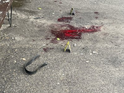 В Охтирці чоловік підірвав гранату. Поранено 5 людей