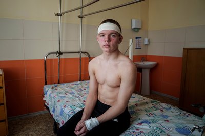 Кирило Ілляшенко, який врятував людей в автобусі під час обстрілу в Сумах, сидить на лікарняному ліжку 14 квітня 2025 року Кирило Ілляшенко, який врятував людей в автобусі під час обстрілу в Сумах, сидить на лікарняному ліжку 14 квітня 2025 року