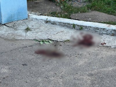 Житомирська волонтерка Ірина Пацева-Коцюба: на мене напали через мою волонтерську діяльність