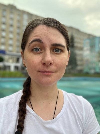 "Я не могла навіть води попити". Хірурги Львова провели реконструкцію лицевого нерва 33-річній жінці