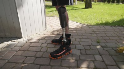 "Виготовляється під кожного пацієнта індивідуально": як у Вінниці захисникам встановлюють біонічні протези "Виготовляється під кожного пацієнта індивідуально": як у Вінниці захисникам встановлюють біонічні протези