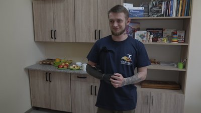 "Виготовляється під кожного пацієнта індивідуально": як у Вінниці захисникам встановлюють біонічні протези "Виготовляється під кожного пацієнта індивідуально": як у Вінниці захисникам встановлюють біонічні протези