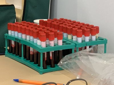 До Дня Незалежності в центрі Києва організували донацію крові для потреб ЗСУ До Дня Незалежності в центрі Києва організували донацію крові для потреб ЗСУ