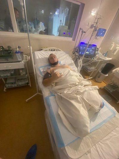 Дмитро після ампутації двох нижніх кінцівок у реанімації в лікарні імені Мечнікова