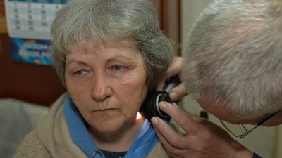 Як розпізнати меланому: у Кропивницькому безплатно перевірятимуть родимки Як розпізнати меланому: у Кропивницькому безплатно перевірятимуть родимки