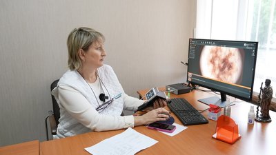 День діагностики меланоми: у Кропивницькому з підозрами на рак шкіри – десятеро людей