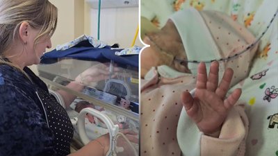 Виходили немовля, яке народилось з вагою 610 грамів у Рівному Виходили немовля, яке народилось з вагою 610 грамів у Рівному