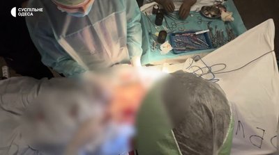 Пересадили шкіру та закрили черевну порожнину: в Одесі провели операцію військовослужбовцю Пересадили шкіру та закрили черевну порожнину: в Одесі провели операцію військовослужбовцю
