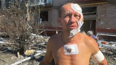 «Моє щастя, що з горла вилетів уламок»: жителі Краматорська про авіаудар «Моє щастя, що з горла вилетів уламок»: жителі Краматорська про авіаудар