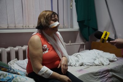 Атака дронів на рейсовий автобус: поранена миропільчанка розповіла про російський удар Атака дронів на рейсовий автобус: поранена миропільчанка розповіла про російський удар