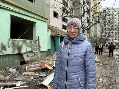 "Зашили ухо. Головне, що живі". Як оговтуються мешканці Сум після удару армії РФ "Зашили ухо. Головне, що живі". Як оговтуються мешканці Сум після удару армії РФ