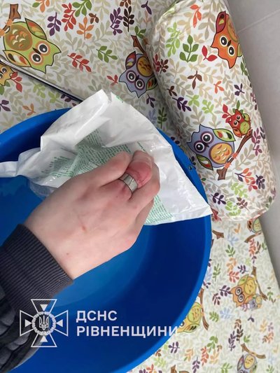 Рятувальники зняли металеве кільце, яке стиснуло палець 15-річного хлопця, на Рівненщині Рятувальники зняли металеве кільце, яке стиснуло палець 15-річного хлопця, на Рівненщині