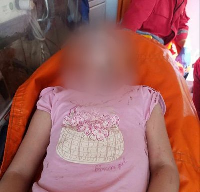 У Полтаві дівчинка постраждала через обірвану гілку у парку "Перемога" У Полтаві дівчинка постраждала через обірвану гілку у парку "Перемога"