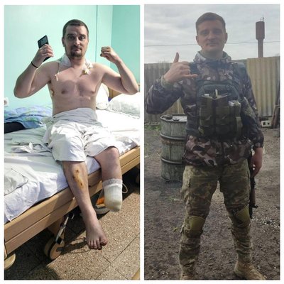 "Кожен день – це як мінімум маленька твоя смерть": історія ветерана з Полтавщини Євгена Пилипенка "Кожен день – це як мінімум маленька твоя смерть": історія ветерана з Полтавщини Євгена Пилипенка
