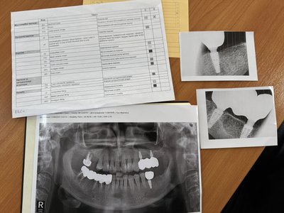Курс із ідентифікації військовослужбовців за стоматологічним статусом проводять в Ужгороді