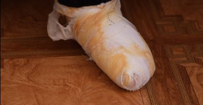 "Світла та тепла не було". До Дніпра з Покровська з обмороженням ніг евакуювали жінку з інвалідністю "Світла та тепла не було". До Дніпра з Покровська з обмороженням ніг евакуювали жінку з інвалідністю