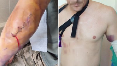 На Кіровоградщині повідомили про підозру інструктору, який побив військовослужбовця на навчальному полігоні