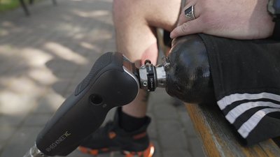 "Виготовляється під кожного пацієнта індивідуально": як у Вінниці захисникам встановлюють біонічні протези "Виготовляється під кожного пацієнта індивідуально": як у Вінниці захисникам встановлюють біонічні протези