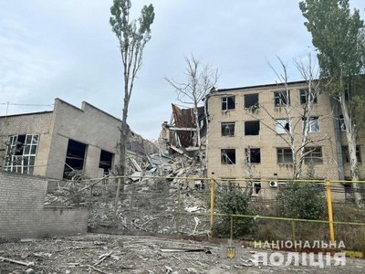 "Залишився без двох ніг": як відновлюється переселенець з Донеччини після служби у війську
