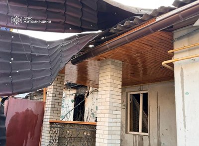 Вибух у Житомирі: 12-річна дівчинка отримала осколкове поранення Вибух у Житомирі: 12-річна дівчинка отримала осколкове поранення