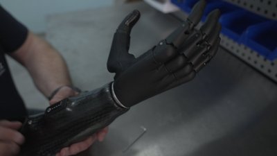 "Виготовляється під кожного пацієнта індивідуально": як у Вінниці захисникам встановлюють біонічні протези "Виготовляється під кожного пацієнта індивідуально": як у Вінниці захисникам встановлюють біонічні протези