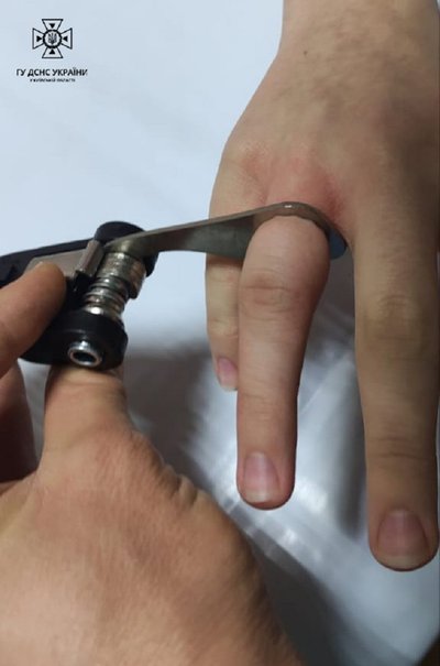Довелося рятували палець: на Київщині підліток невдало погрався з мультульним ключем Довелося рятували палець: на Київщині підліток невдало погрався з мультульним ключем