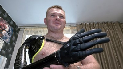 "Осколок відсік руку і попав у щелепу": історія волинського ветерана війни Михайла Бартошика "Осколок відсік руку і попав у щелепу": історія волинського ветерана війни Михайла Бартошика