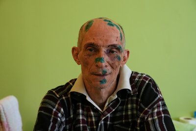 Що відомо про стан поранених після удару по Сумах Що відомо про стан поранених після удару по Сумах