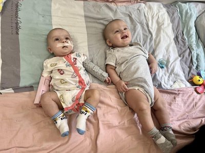 Львівські хірурги прооперували немовля з Івано-Франківська з незрощенням губи Львівські хірурги прооперували немовля з Івано-Франківська з незрощенням губи