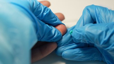 На Вінниччині безкоштовно тестують на ВІЛ та вірусні гепатити На Вінниччині безкоштовно тестують на ВІЛ та вірусні гепатити