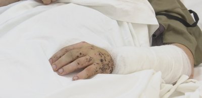 "FPV-дрон полював за мною". Боєць, який втратив ноги внаслідок атаки дрона, проходить лікування на Дніпропетровщині "FPV-дрон полював за мною". Боєць, який втратив ноги внаслідок атаки дрона, проходить лікування на Дніпропетровщині