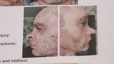 Артем Тищенко, ветеран Артем Тищенко, ветеран