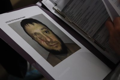 30 операцій військовим за чотири дні. У Франківську канадські та американські хірурги завершили місію "Face the Future" 30 операцій військовим за чотири дні. У Франківську канадські та американські хірурги завершили місію "Face the Future"