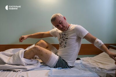Поранений уламками російського дрона староста Антонівки Сергій Іващенко в лікарні у Херсоні Поранений уламками російського дрона староста Антонівки Сергій Іващенко в лікарні у Херсоні
