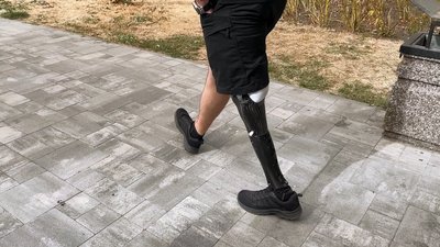 Протез військового Дмитра Устименка Протез військового Дмитра Устименка