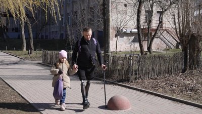 ветеран, протези, діти, ампутація ветеран, протези, діти, ампутація