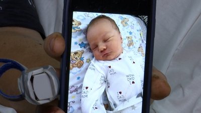 "Мене оперували, а дружина народжувала". У Дніпрі врятували життя пораненому військовому "Мене оперували, а дружина народжувала". У Дніпрі врятували життя пораненому військовому