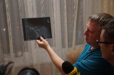 Атака дронів на рейсовий автобус: поранена миропільчанка розповіла про російський удар Атака дронів на рейсовий автобус: поранена миропільчанка розповіла про російський удар