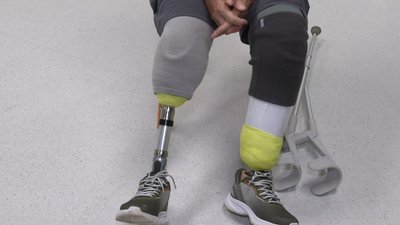 На дідуся чекають 4 онучки: на Львівщині поранений прикордонник став на два протези На дідуся чекають 4 онучки: на Львівщині поранений прикордонник став на два протези