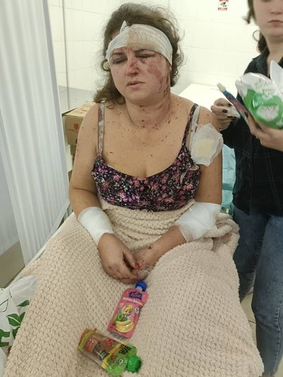 На Дніпропетровщині лікують поранену після обстрілу Павлограда 6 вересня: в якому вона стані На Дніпропетровщині лікують поранену після обстрілу Павлограда 6 вересня: в якому вона стані