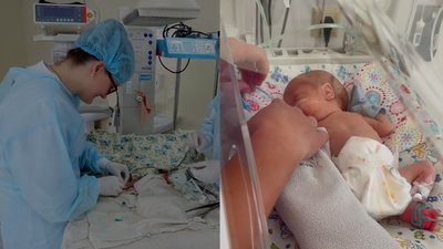 У Рівному немовля народилося вагою в майже 900 грамів У Рівному немовля народилося вагою в майже 900 грамів