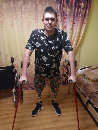 "Прийшов до тями, подивився на ноги, а їх немає" — військовослужбовець 95 десантно-штурмової бригади Микола Тарасенко "Прийшов до тями, подивився на ноги, а їх немає" — військовослужбовець 95 десантно-штурмової бригади Микола Тарасенко