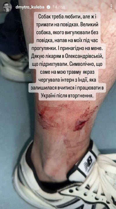 У Києві главу МЗС Дмитра Кулебу покусав собака У Києві главу МЗС Дмитра Кулебу покусав собака