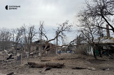 "Біля вікна стояв". Травмований житель Слов'янська розказав про авіаудар, під час якого пошкодило пологовий "Біля вікна стояв". Травмований житель Слов'янська розказав про авіаудар, під час якого пошкодило пологовий