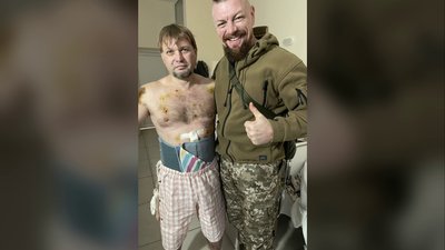 Фото Вадима після поранення Фото Вадима після поранення