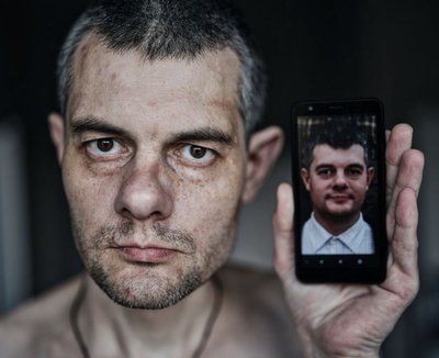 Ігор Шишко після полону Ігор Шишко після полону