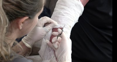 "Боялась дотиками зробити боляче". Чернівчанка Артенюк доглядає за хлопцем після того, як той отримав опіки на фронті "Боялась дотиками зробити боляче". Чернівчанка Артенюк доглядає за хлопцем після того, як той отримав опіки на фронті