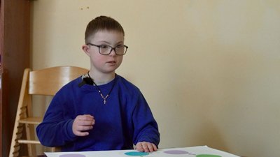 синдром дауна, бебіко