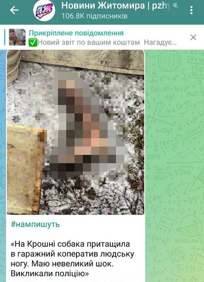 В Житомирі знайшли частину ноги людини
